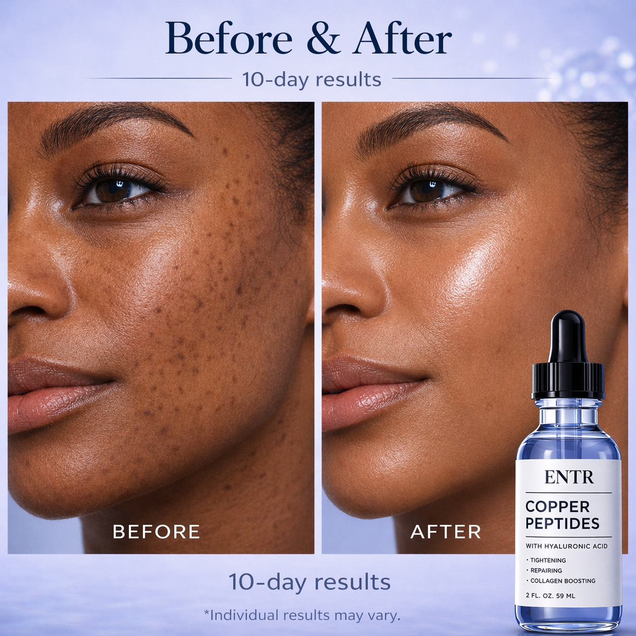 ENTR™ - Copper Peptide Serum