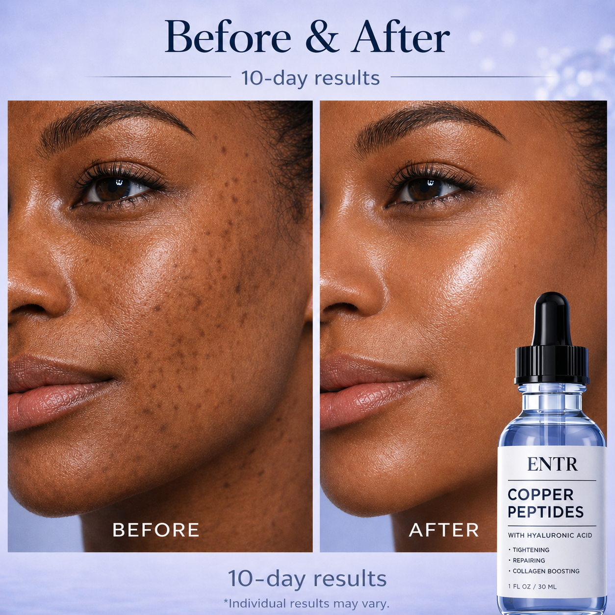 ENTR™ - Copper Peptide Serum
